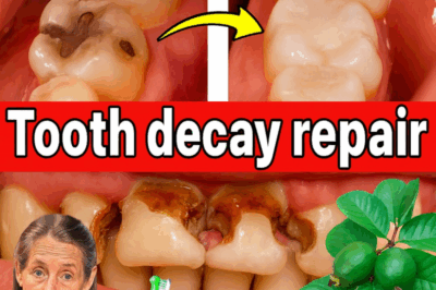 Can Guava Leaves Save Your Smile? The Natural Secret to Fighting Tooth Decay