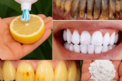 ✨ Dazzle with a Radiant Smile: The Lemon and Baking Soda Secret